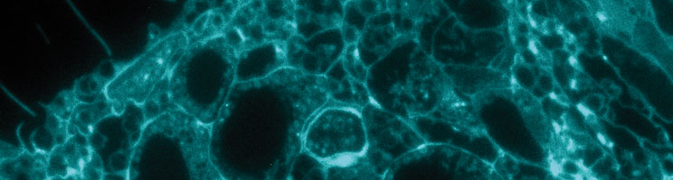 Fluoreszenzbeleuchtung