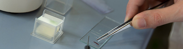 Objektträger und Deckgläser